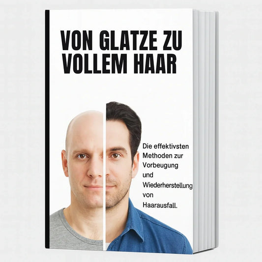 From Balding to Full Hair – E-Book