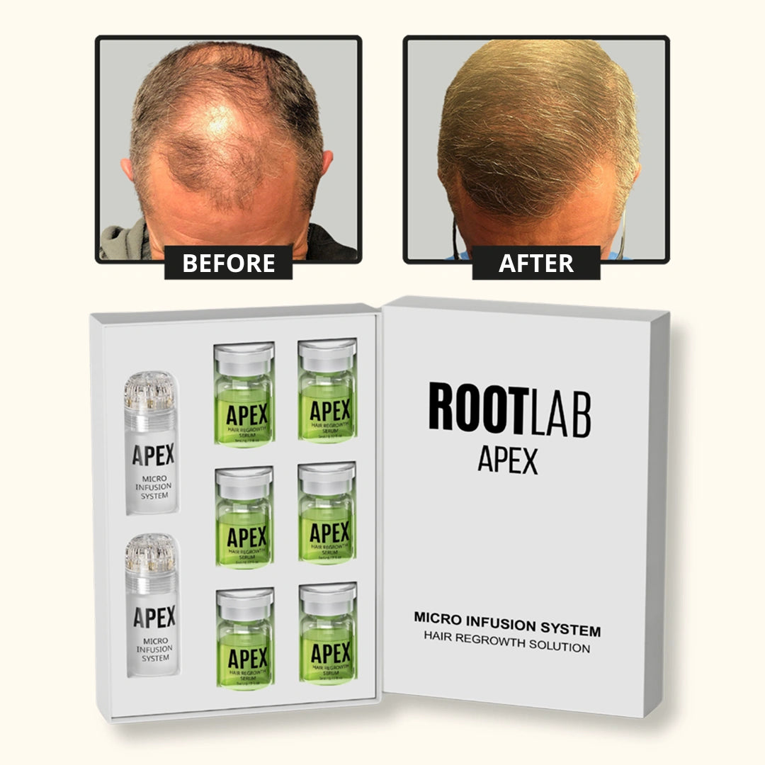 Apex™ Hair Regrowth System