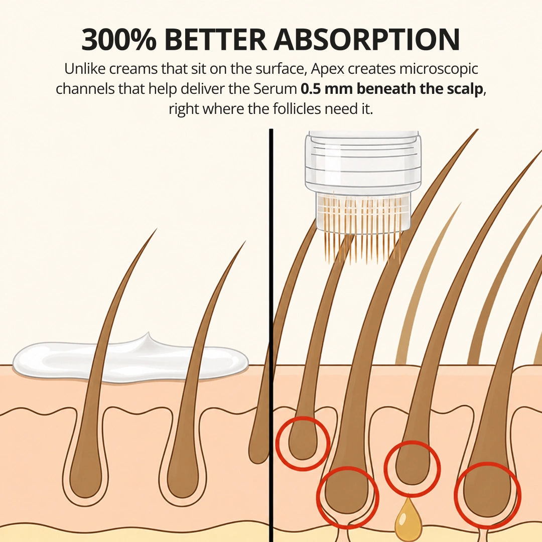 Apex™ Hair Regrowth System