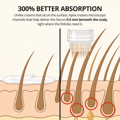 Apex™ Hair Regrowth System