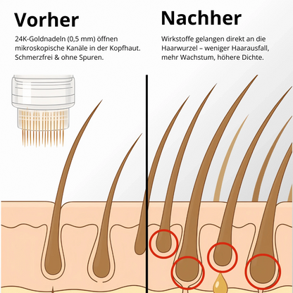 Apex Hair Regrowth System