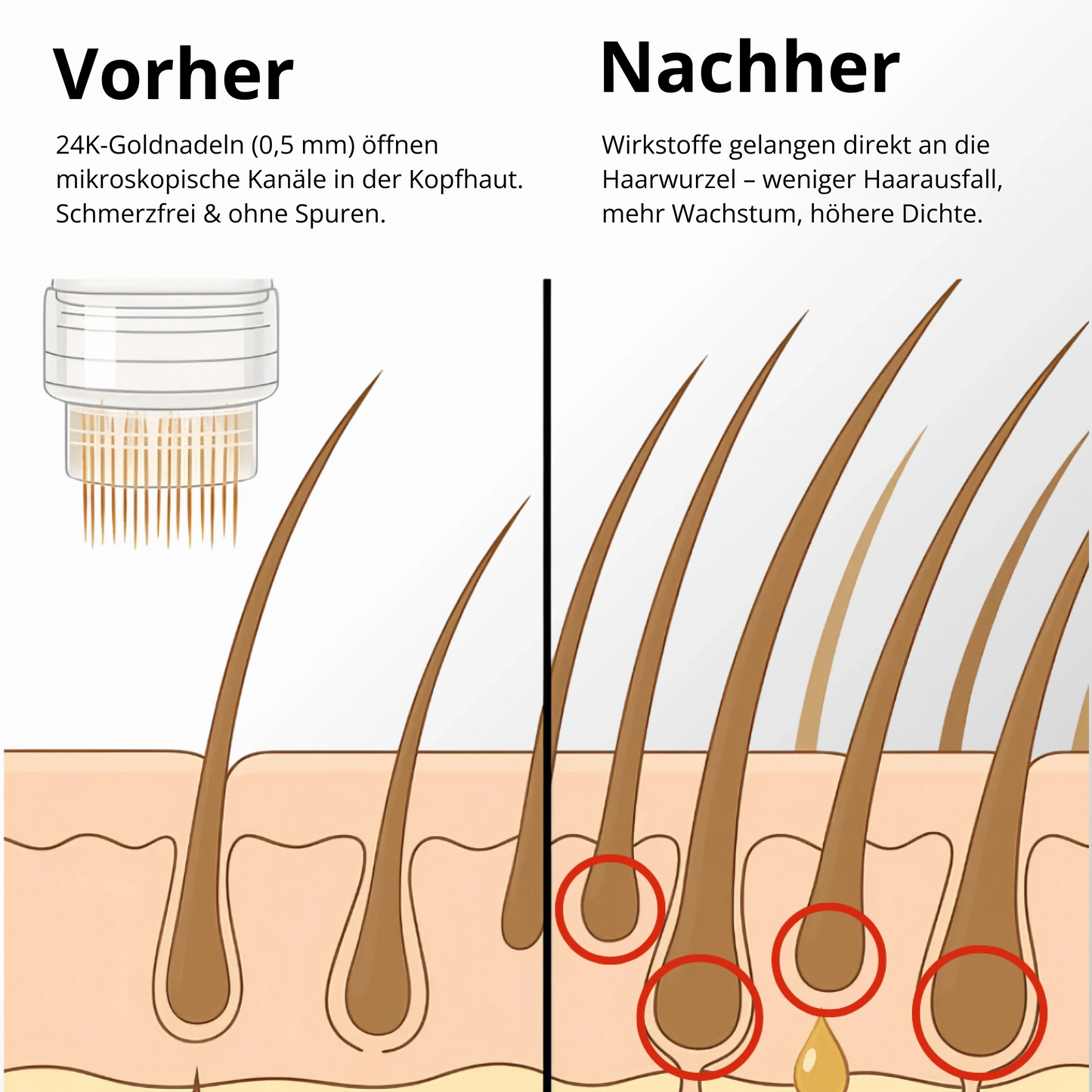 Apex Hair Regrowth System